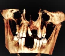 Centro radiológico con CBCT y escáner intraoral