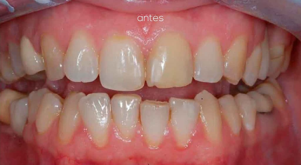 Con nuestros dentistas su sonrisa perfecta es posible