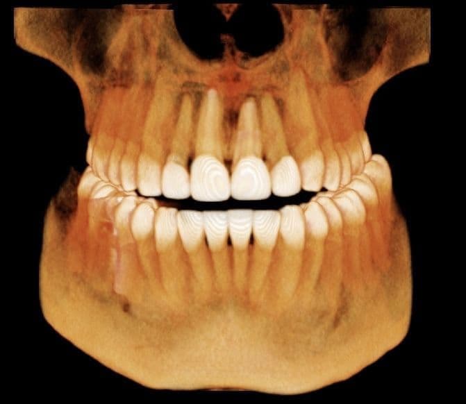 Conserve sus dientes: tratamientos avanzados para conducto y encías