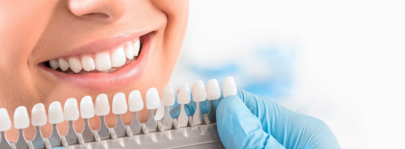 Dientes perfectos y cuidado mínimo con Rianxo Dental