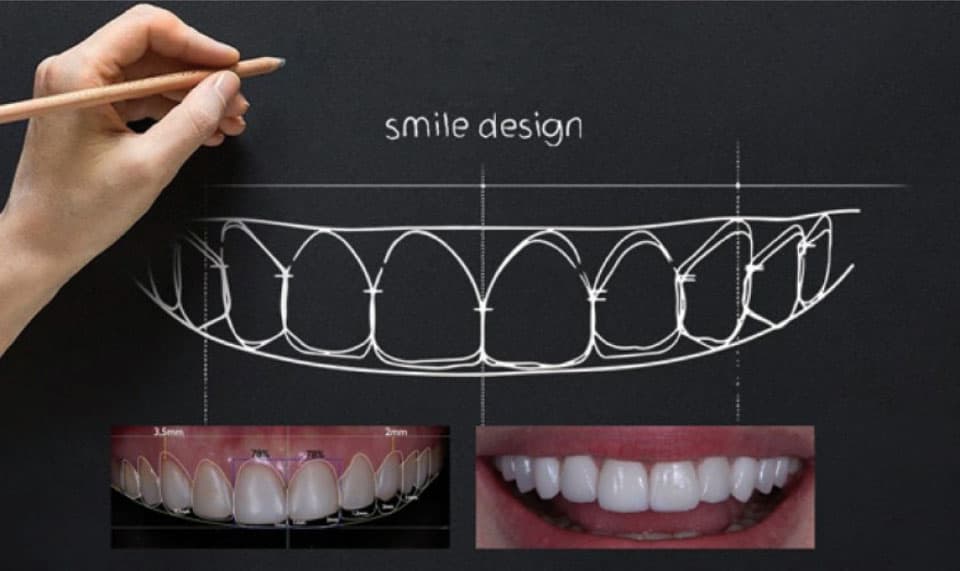 Eficiencia y estética con Rianxo Dental