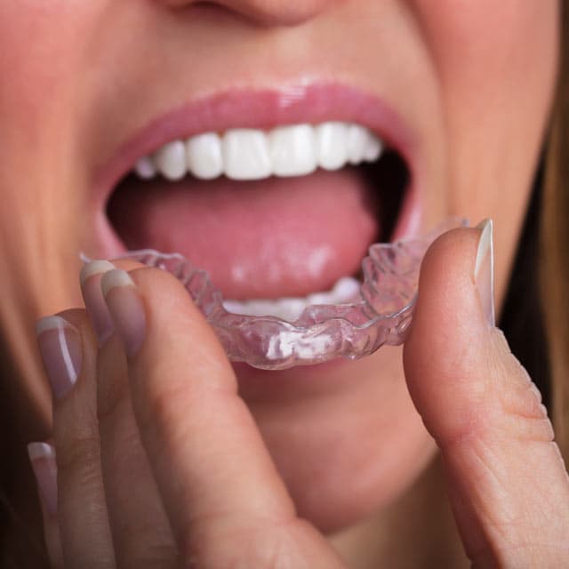 Clínica dental especializada en bruxismo en Rianxo