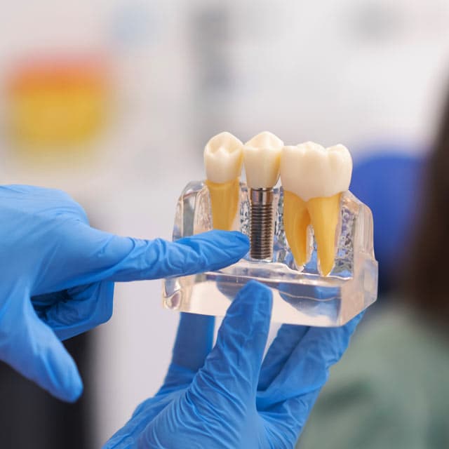 Expertos en implantes dentales en Rianxo