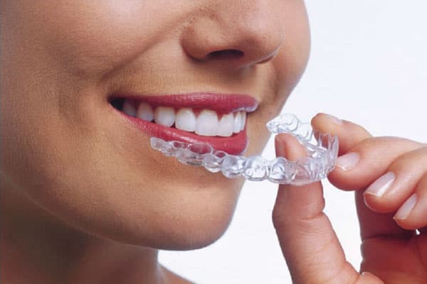 ¿Quién está detrás de su próxima sonrisa perfecta?